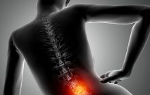 Почему болит спина: разбираемся в причинах и находим решение