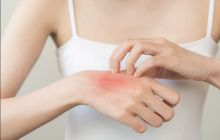 Зуд кожи: причины, опасные сигналы и как избавиться