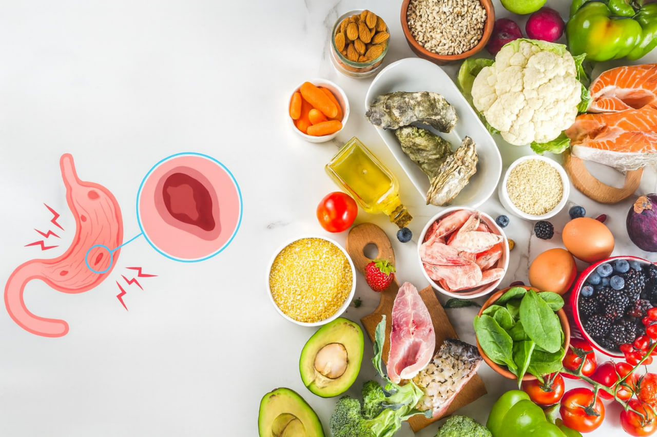 дієта при виразці шлунка