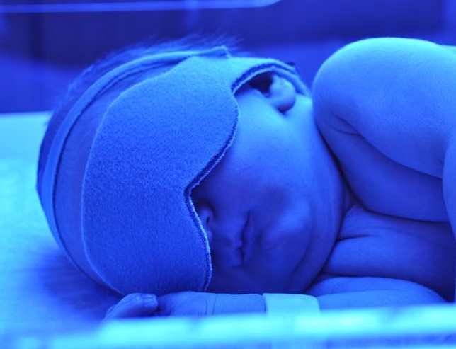лікування жовтяниці у новонароджених